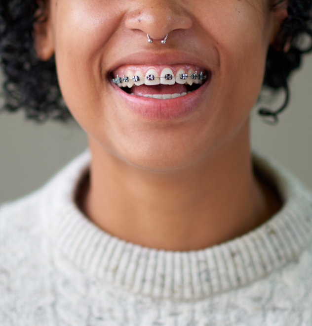 Take the first step towards your new smile