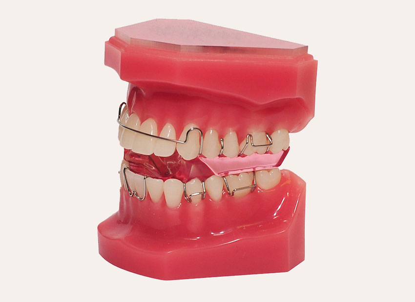 Functional growth appliances