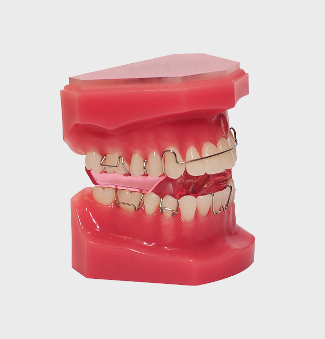 Twin Block appliance